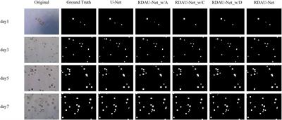 A novel deep learning segmentation model for organoid-based drug screening